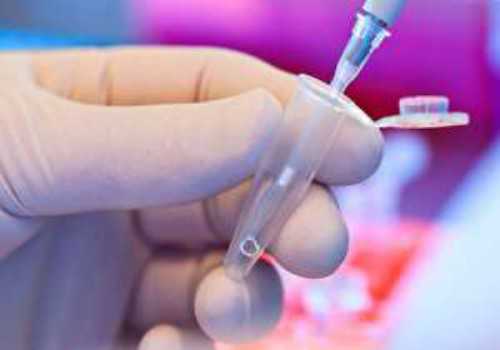 子宫息肉癌变的标准