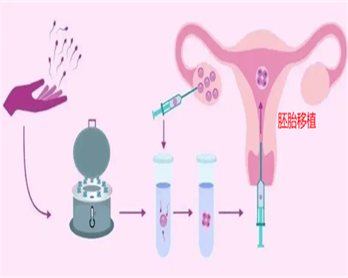 盆腔炎患者的饮食良方：告别炎症困扰