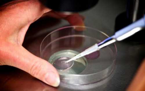 子宫肌瘤：大小的分界与处理策略