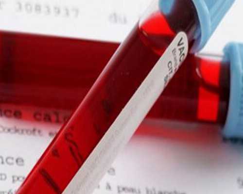 男性如何预防不育:需注意的8件事