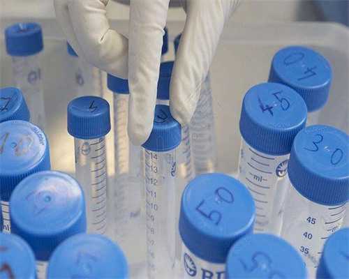 染色体异常做几代试管,Y染色体异常可以做几代试管